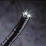 Gastroscope
